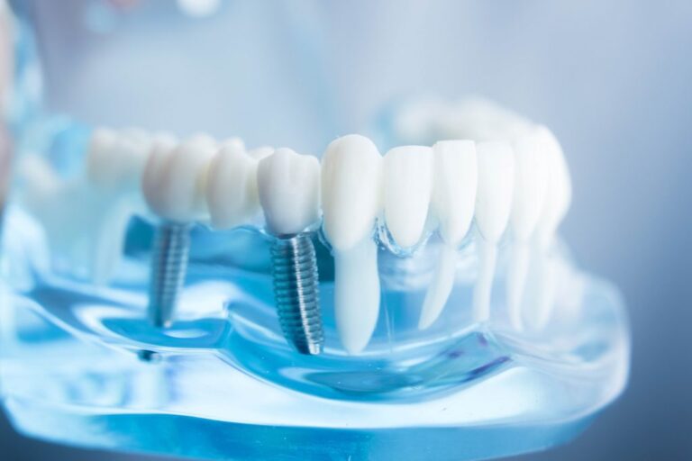Nerovet ai dentistry